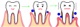 A mélyre jutó ínygyulladásról: a fogágybetegségről
